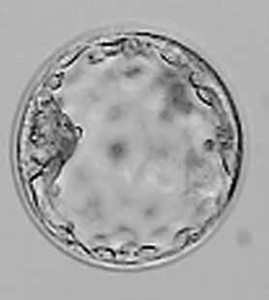 D5 Human embryo