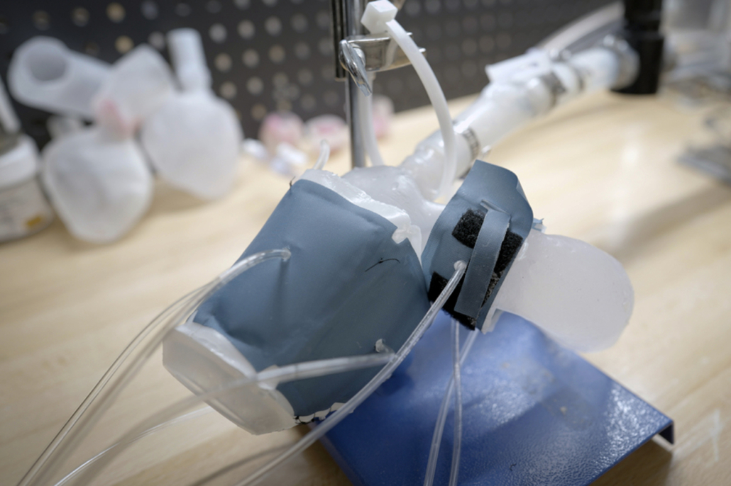 The action of the soft, robotic models can be controlled to mimic the patient’s blood-pumping ability. Image: Melanie Gonick, MIT