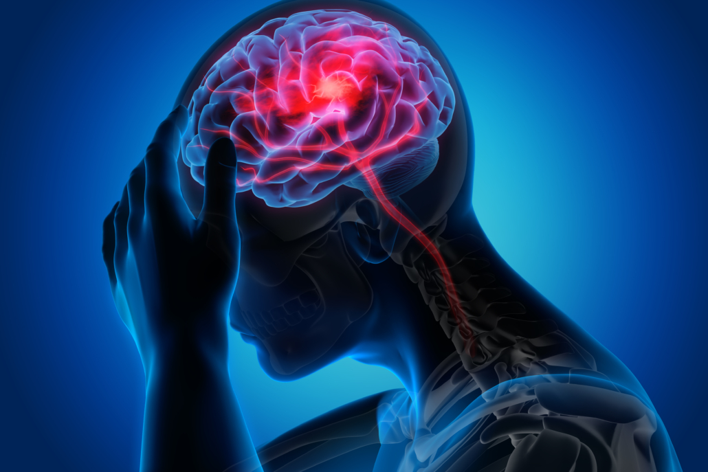 U.S. FDA approves atogepant for adults with chronic migraine