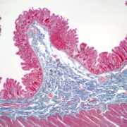 microscopic view of large intestine