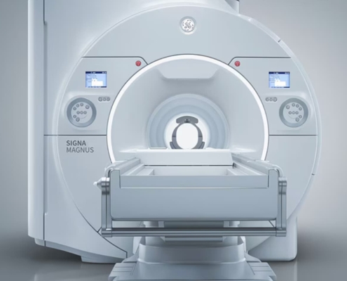 GE HealthCare SIGNA MAGNUS MRI