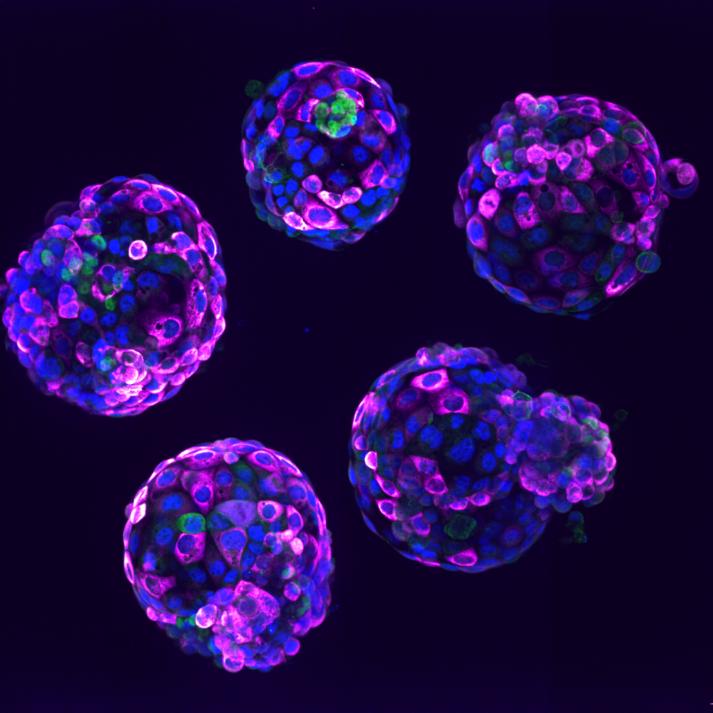 Human stem cell-based embryo model – Blastoids. Blue marks all nuclei, the green label marks cells of the inner cell mass, and the pink label is a readout of a ribosomal protein. 