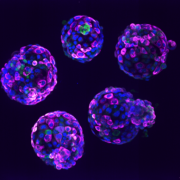 3. Human stem cell-based embryo model – Blastoids. Blue marks all nuclei, the green label marks cells of the inner cell mass, and the pink label is a readout of a ribosomal protein.