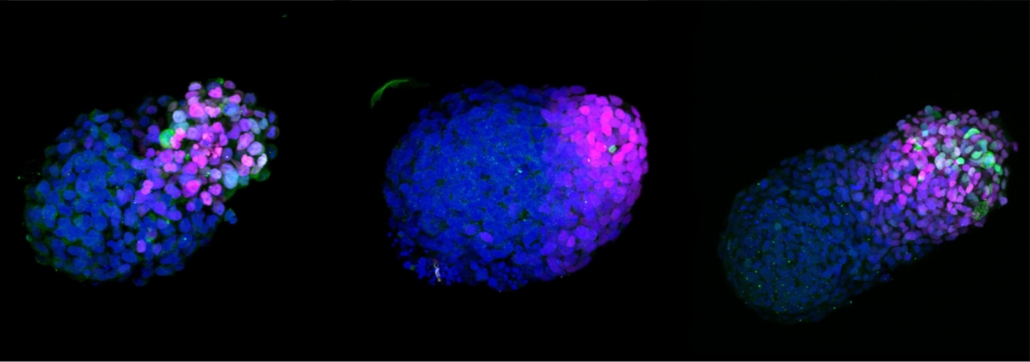 A growing stem cell-based embryo model 24h (left), 48h (middle) and 72h (right) after embryonic stem cell aggregation. 