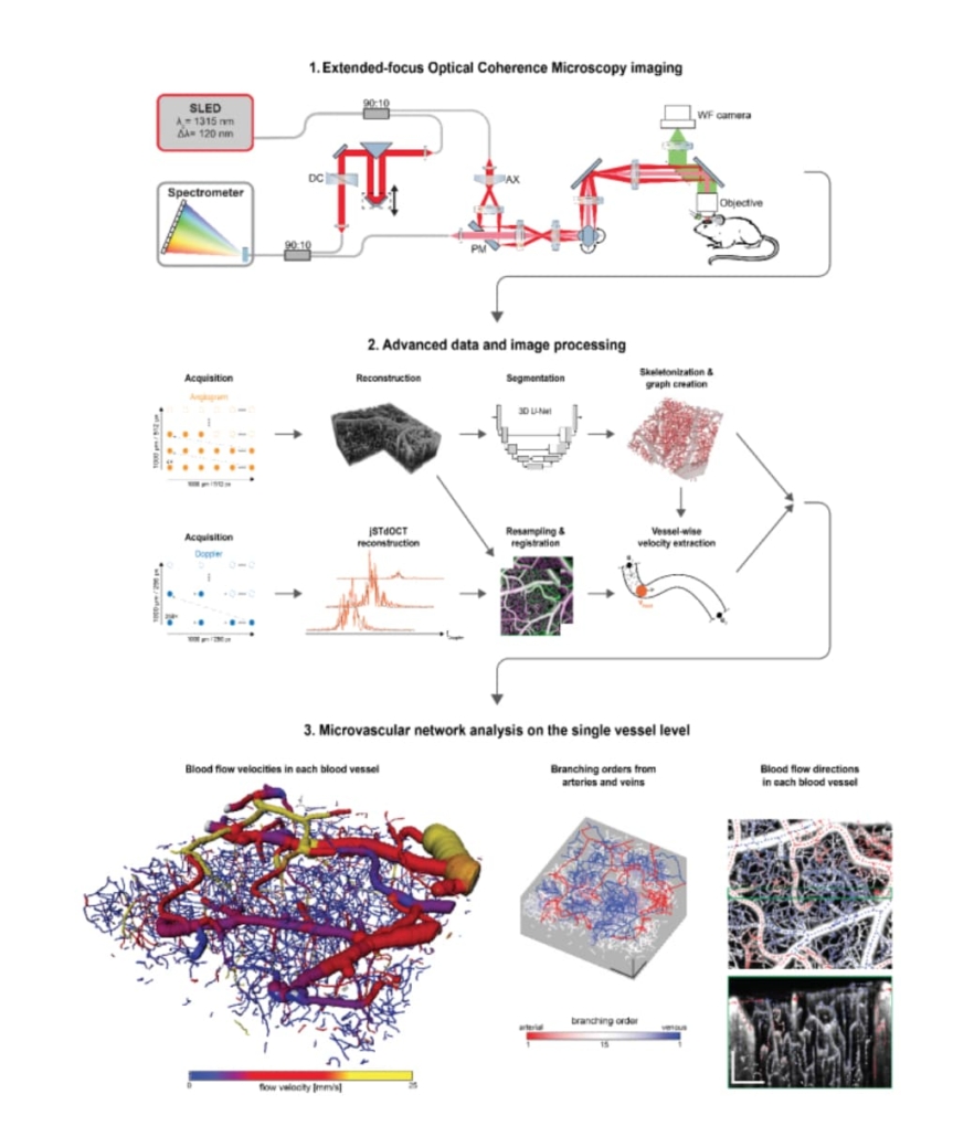 Novel advanced brain imaging technique 