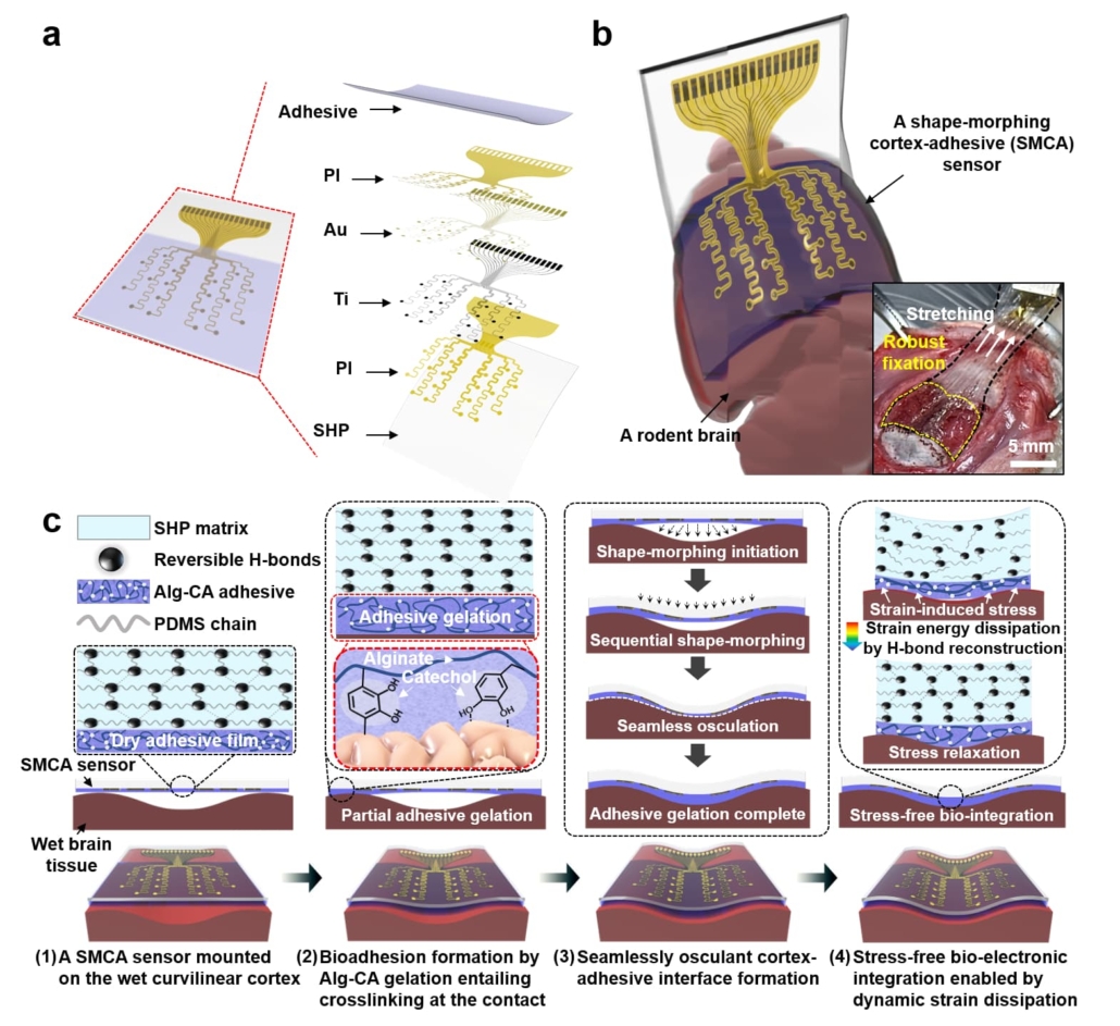 Novel brain-adhesive sensor enables precise epilepsy treatment monitoring