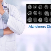 New Alzheimer's Clinical Diagnostic Guideline