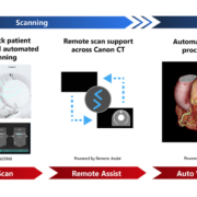 Canon Medical Systems advances AI workflow automation for CT imaging