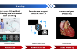 Canon Medical Systems advances AI workflow automation for CT imaging