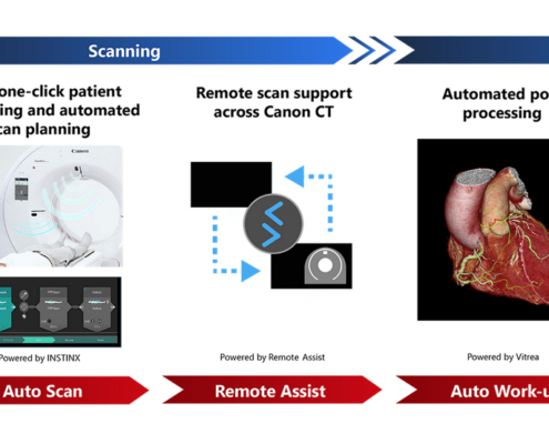 Canon Medical Systems advances AI workflow automation for CT imaging