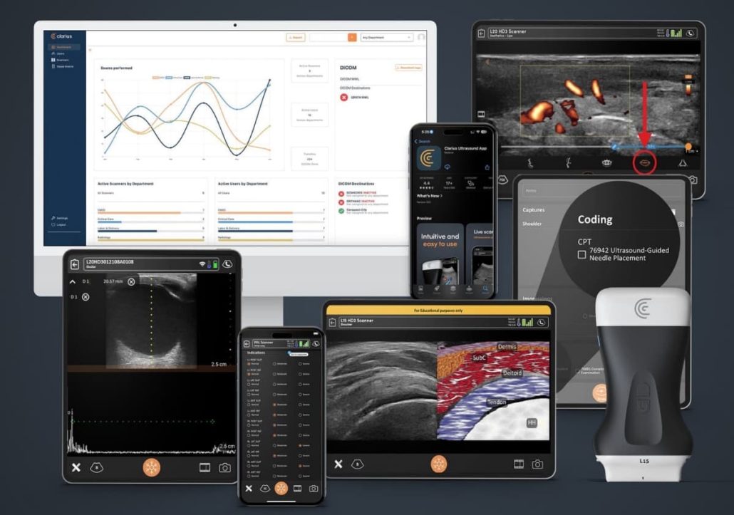 Clarius introduces AI-enhanced ultrasound software innovations