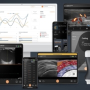 Clarius introduces AI-enhanced ultrasound software innovations