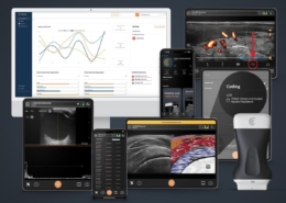 Clarius introduces AI-enhanced ultrasound software innovations