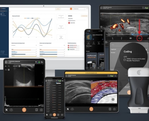 Clarius introduces AI-enhanced ultrasound software innovations