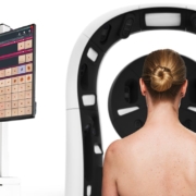 Skin cancer prevention using the full body scanner within the iToBoS-Project