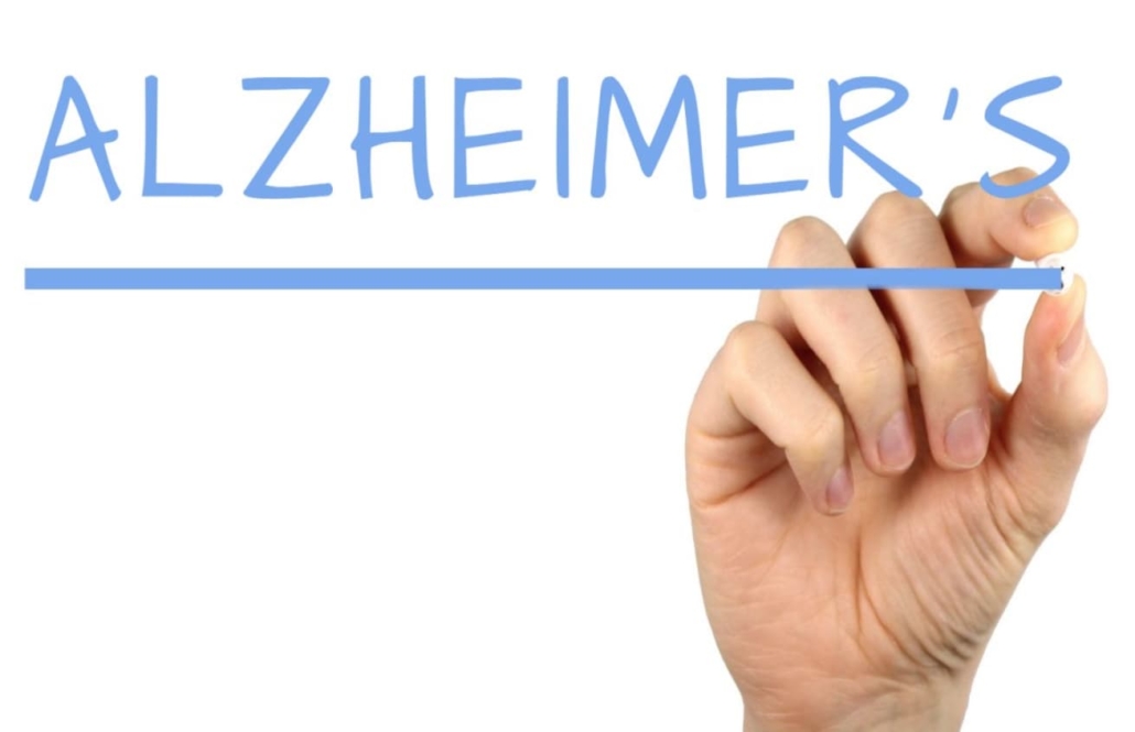 model to predict Alzheimer’s disease onset