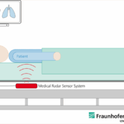 Radar technology enables contactless patient vital sign monitoring