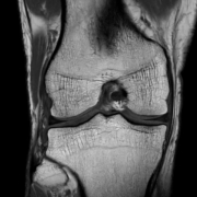 SmartSpeed Precise clinical knee image