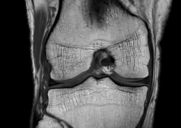 SmartSpeed Precise clinical knee image