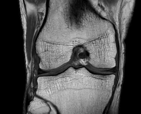 SmartSpeed Precise clinical knee image