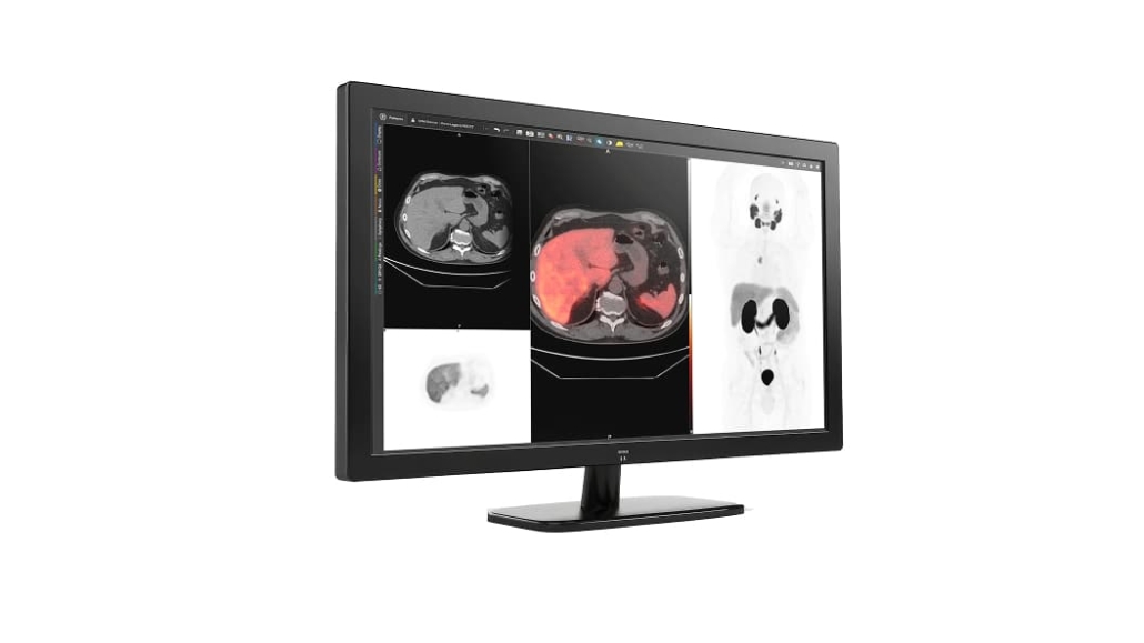 GE HealthCare advances precision imaging with MIM Encore platform