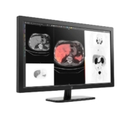 GE HealthCare advances precision imaging with MIM Encore platform