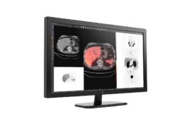 GE HealthCare advances precision imaging with MIM Encore platform