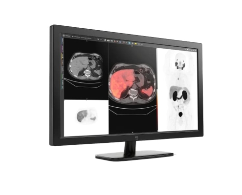 GE HealthCare advances precision imaging with MIM Encore platform