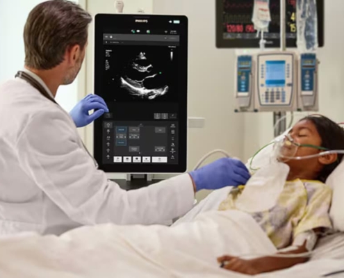 Philips Flash Ultrasound System 5100 POC