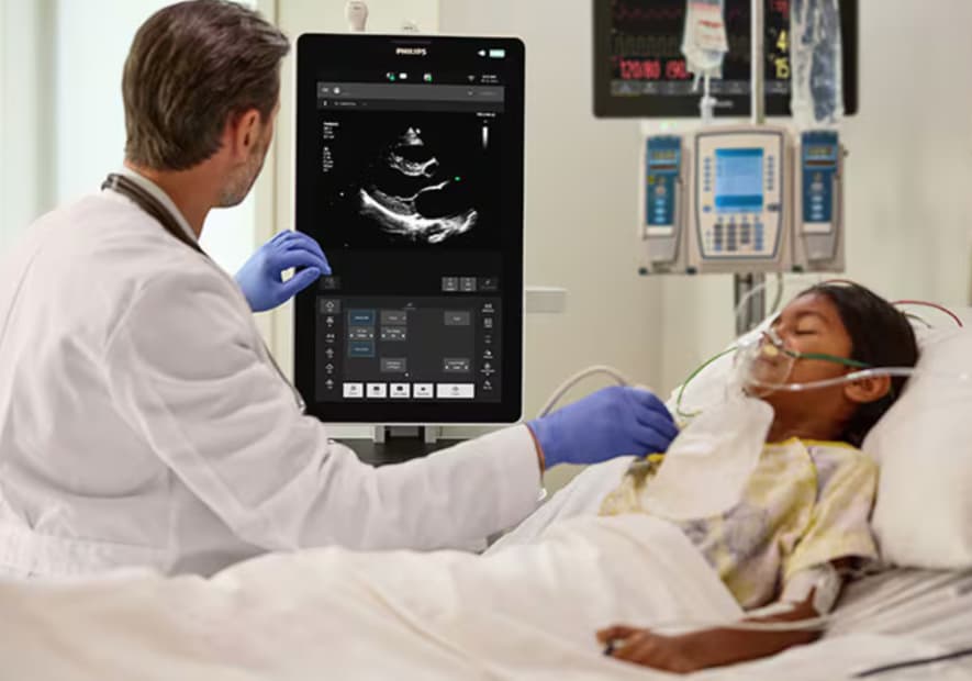 Philips Flash Ultrasound System 5100 POC