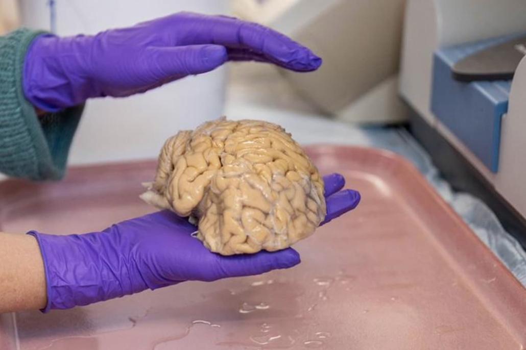  scientist at Northwestern University holds a donated SuperAger brain in Chicago, IL