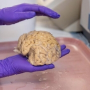 scientist at Northwestern University holds a donated SuperAger brain in Chicago, IL
