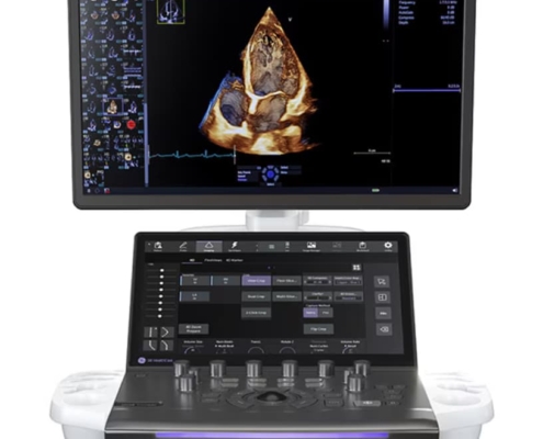 GE HealthCare unveils Vivid Pioneer ultrasound system