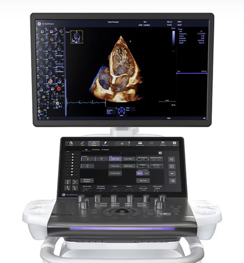 GE HealthCare unveils Vivid Pioneer ultrasound system with 360% faster AI performance