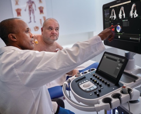 Philips launches Transcend Plus for EPIQ CVx and Affiniti CVx ultrasound