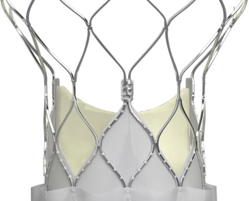 Abbott’s Navitor TAVI system receives CE mark for expanded indication to treat low and intermediate surgical risk aortic stenosis