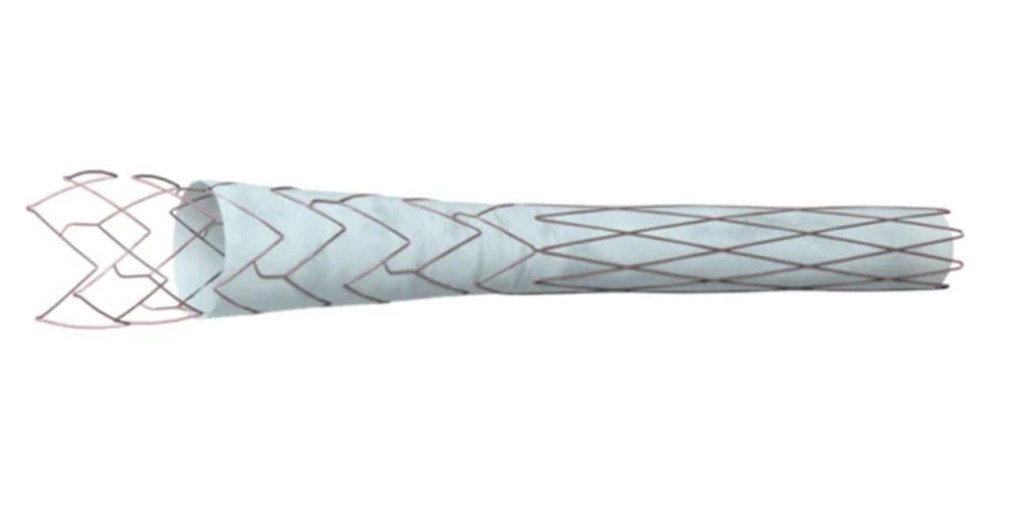 : Phraxis completes first commercial EndoForce anastomotic connector procedure at Spartanburg Regional, marking new era in dialysis vascular access technology.