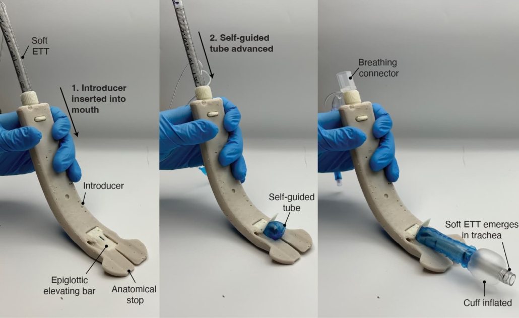 Soft Robotic Intubation System (SRIS)