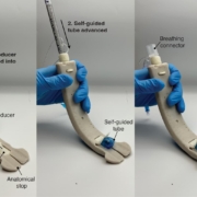 Soft Robotic Intubation System (SRIS)