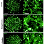Microglia integrated in human brain organoids respond to toxin-induced demyelination with morphological changes. Representative immunofluorescence images show microglia (IBA1, green) in a human brain organoid model. Panels show the response to control conditions, demyelination (induced by toxin), and remyelination, respectively. Magnified insets an the right highlight the detailed morphological changes of microglia in each condition.
