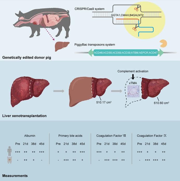 World’s first pig-to-human liver xenotransplant