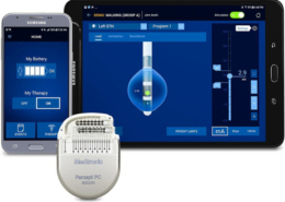 Medtronic’s BrainSense adaptive DBS system wins TIME recognition