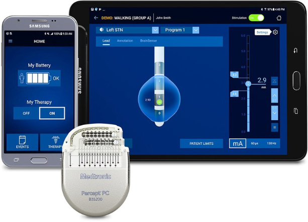 Medtronic’s BrainSense adaptive DBS system wins TIME recognition