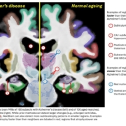 © Martina Bocchetta, Dorit Kliemann and Juan Eugenio Iglesias