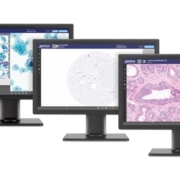 Hologic’s Genius Digital Diagnostics System