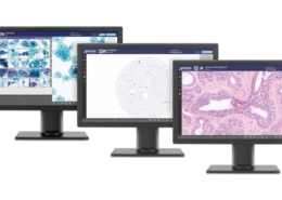 Hologic’s Genius Digital Diagnostics System