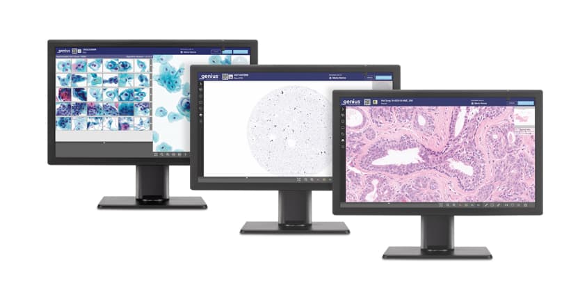 Hologic’s Genius Digital Diagnostics System